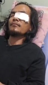 Pengeroyokan dan Intimidasi Terhadap Wartawan Kembali Terjadi Di Bekasi, Aparat Kepolisian Diminta Turun Tangan