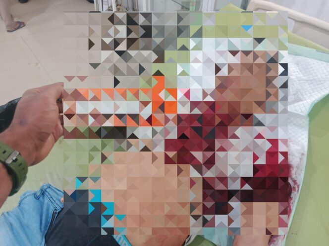 
					Respon Cepat Satgas Damai Cartenz, Korban Kekerasan di Paniai Tertangani, Pelaku Diburu Aparat