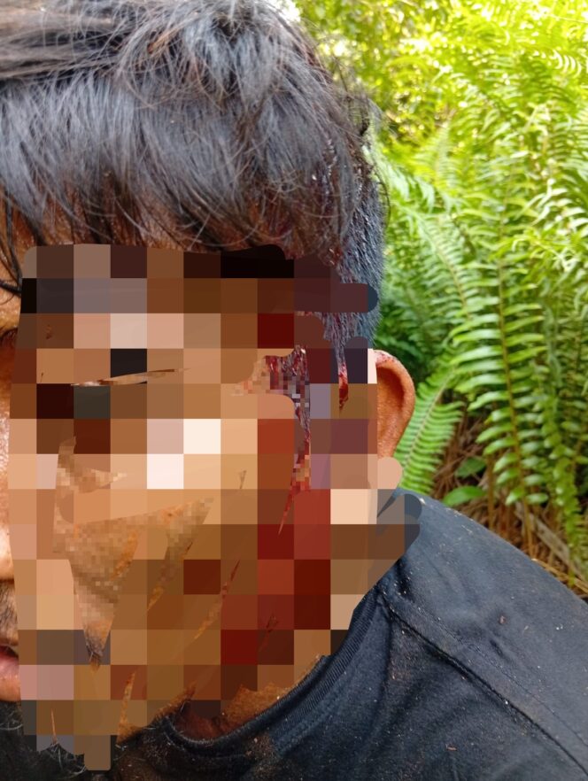 
					PENGANIAYAAN BERULANG TERHADAP PEKERJA DI DESA SUNGAI APUNG, KELOMPOK TANI SUMBER SARI DESAK KAPOLRES LABUHANBATU BERTINDAK TEGAS