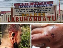 Korban Kecewa, Penetapan Tersangka Kasus Dugaan Pengeroyokan di Polres Labuhanbatu Belum Tetapkan