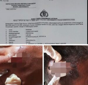 Panggilan Penyidik Diduga Diabaikan, Korban Minta Polres Labuhanbatu Tidak Kalah Dengan Pelaku Kejahatan