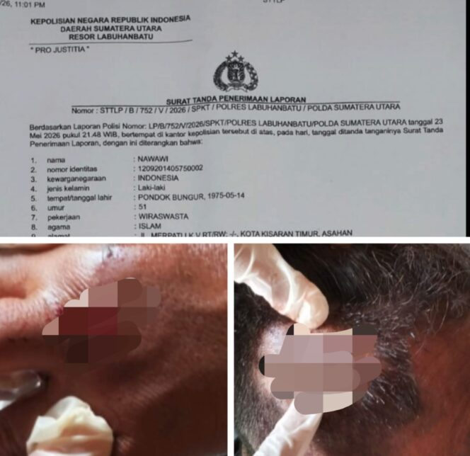 
					Panggilan Penyidik Diduga Diabaikan, Korban Minta Polres Labuhanbatu Tidak Kalah Dengan Pelaku Kejahatan