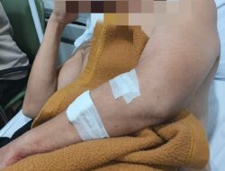 Dua Security Cafe Andrews Party Diduga Jadi Korban Pengeroyokan, Kasus Dilaporkan ke Polisi