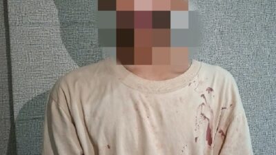Polisi Tangkap Terduga Pelaku Penganiayaan di Cilincing, Seorang Buruh Tewas Dibacok Clurit